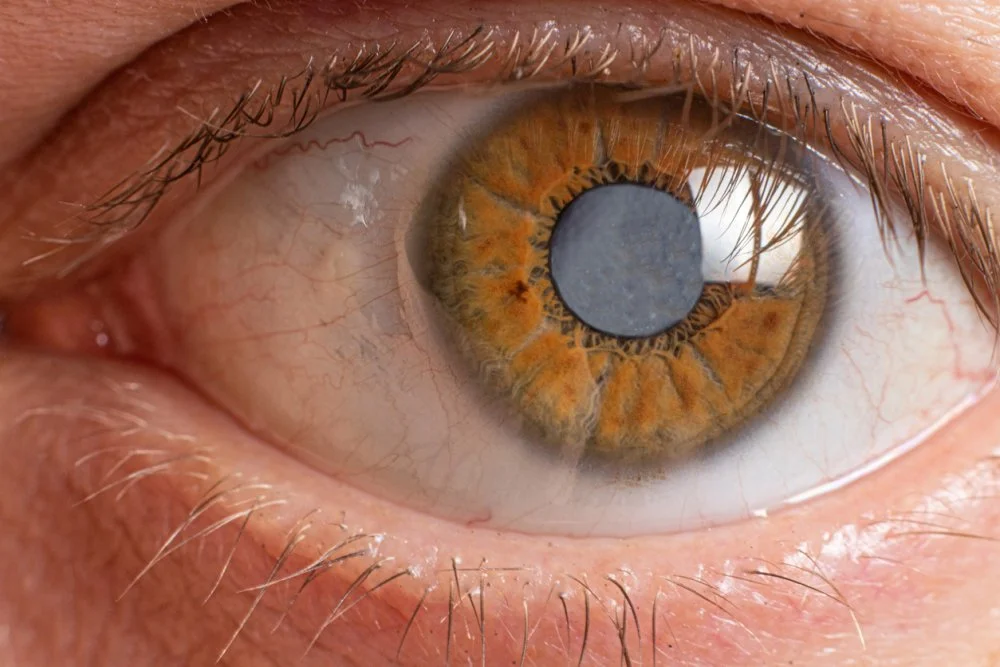 Is cataract surgery dangerous
