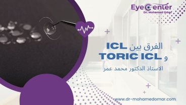 سعر زراعة عدسات ICL في مصر