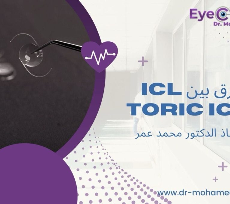 سعر زراعة عدسات ICL في مصر